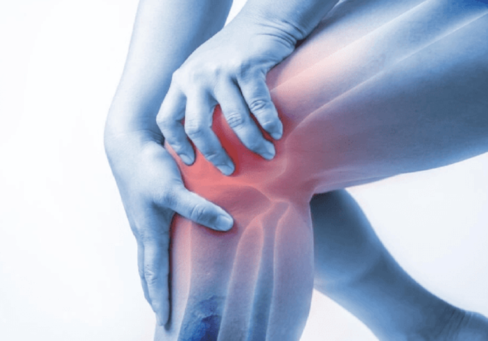 Knee Pain Diet Plan